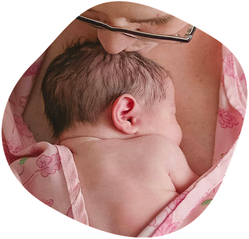 newborn skin